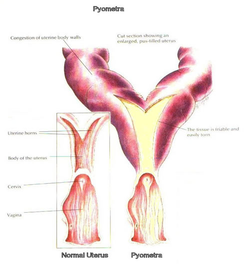 drawing of an enlarged uterus with pyometra